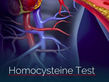 Homocysteine Test